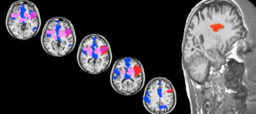this is your brain on love_frum_lewis
